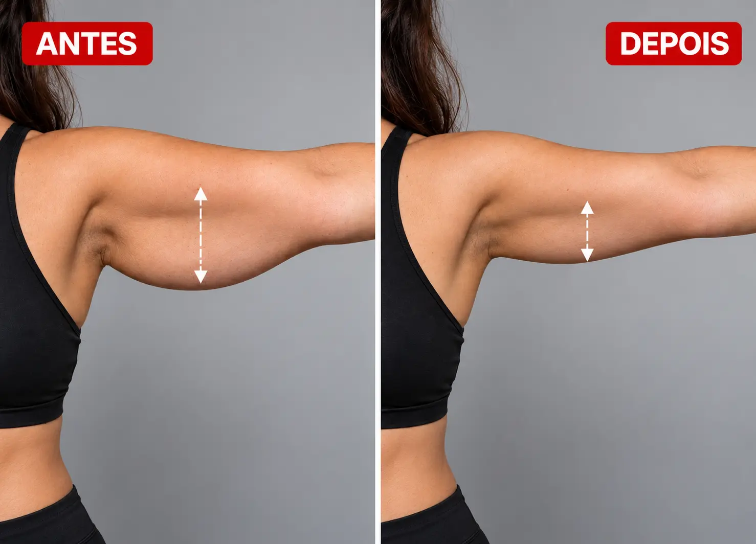 Antes e depois com medidas do braço